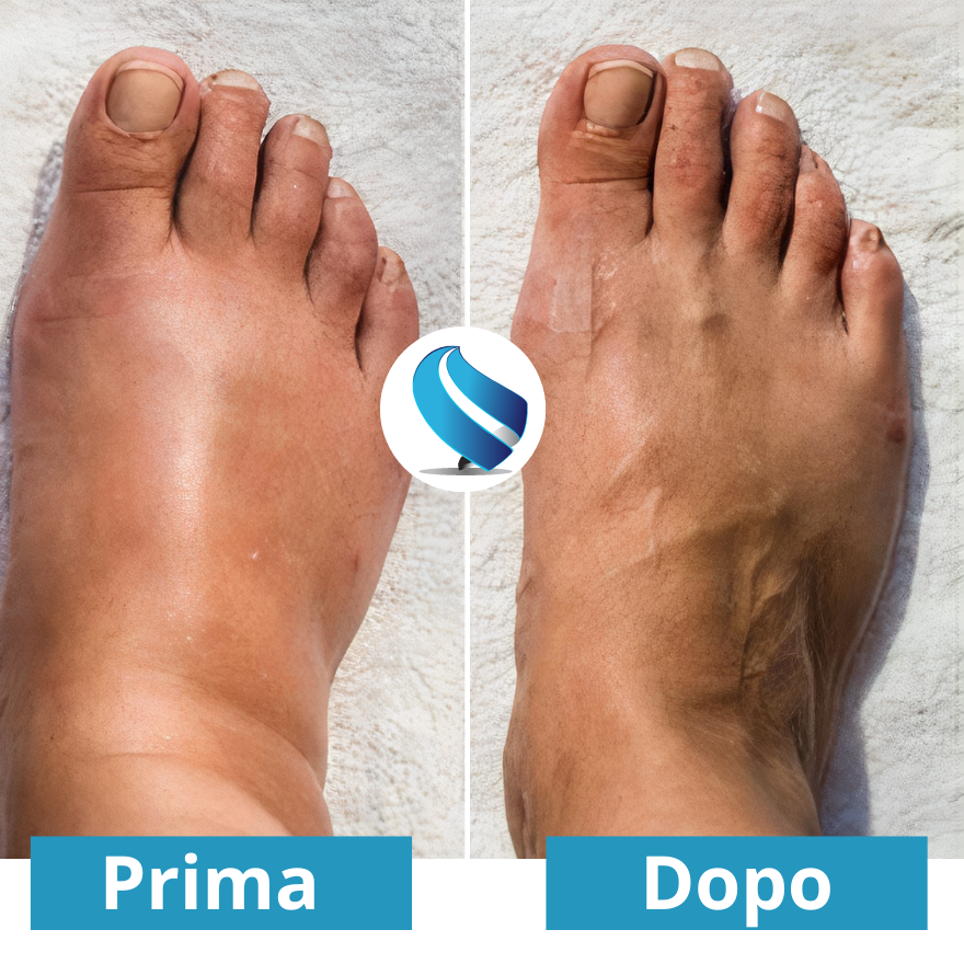 Massaggiatore per piedi NEMS - Per un sollievo duraturo dal dolore ai piedi