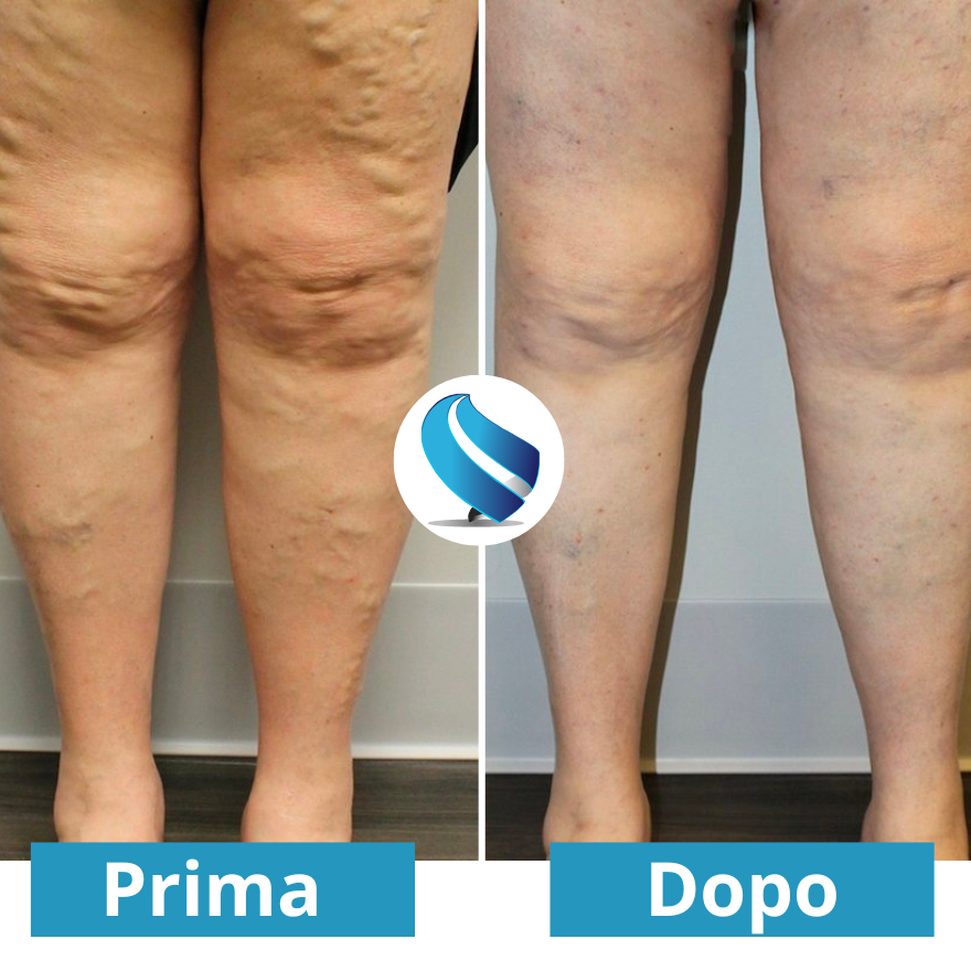 Massaggiatore per piedi NEMS - Per un sollievo duraturo dal dolore ai piedi