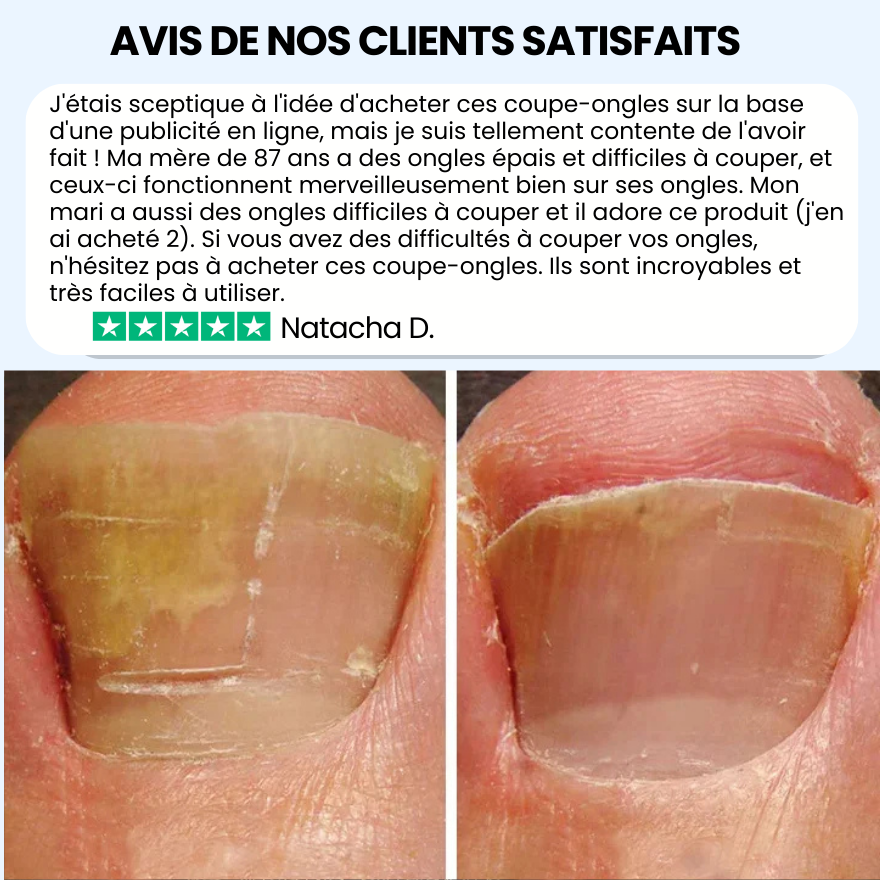 Coupe-Ongles Premium PRO POSTUR - Une Solution Facile et Sans Douleur