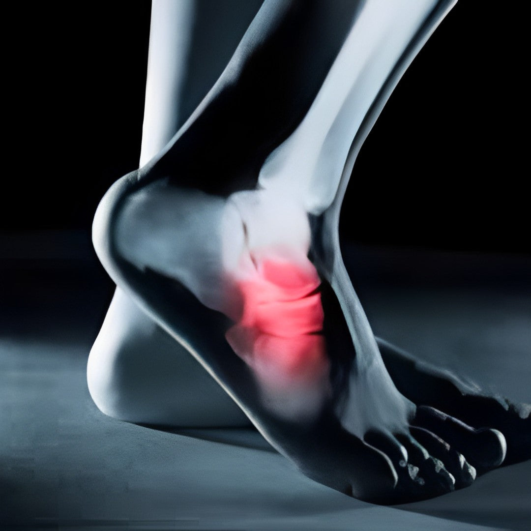Sandales orthopédiques pour les oignons