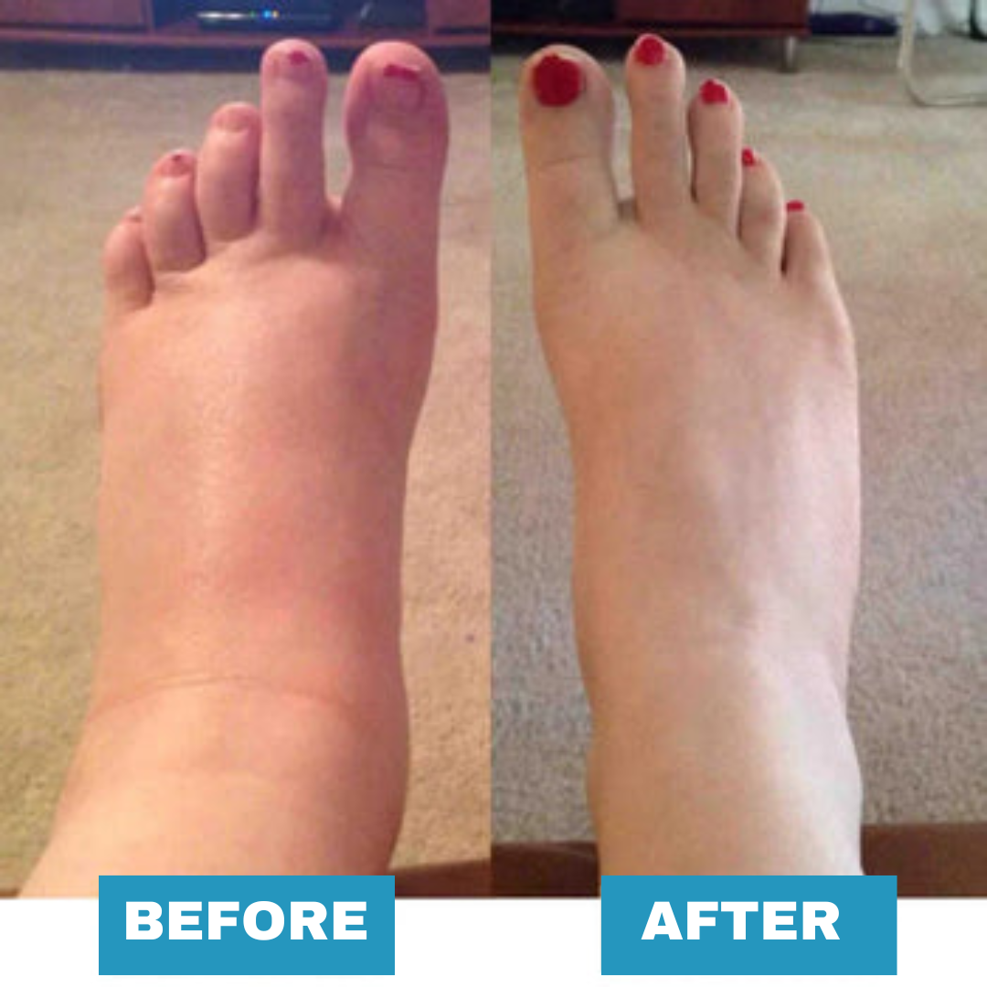 EMS Foot Massager - For Lasting Foot Pain Relief