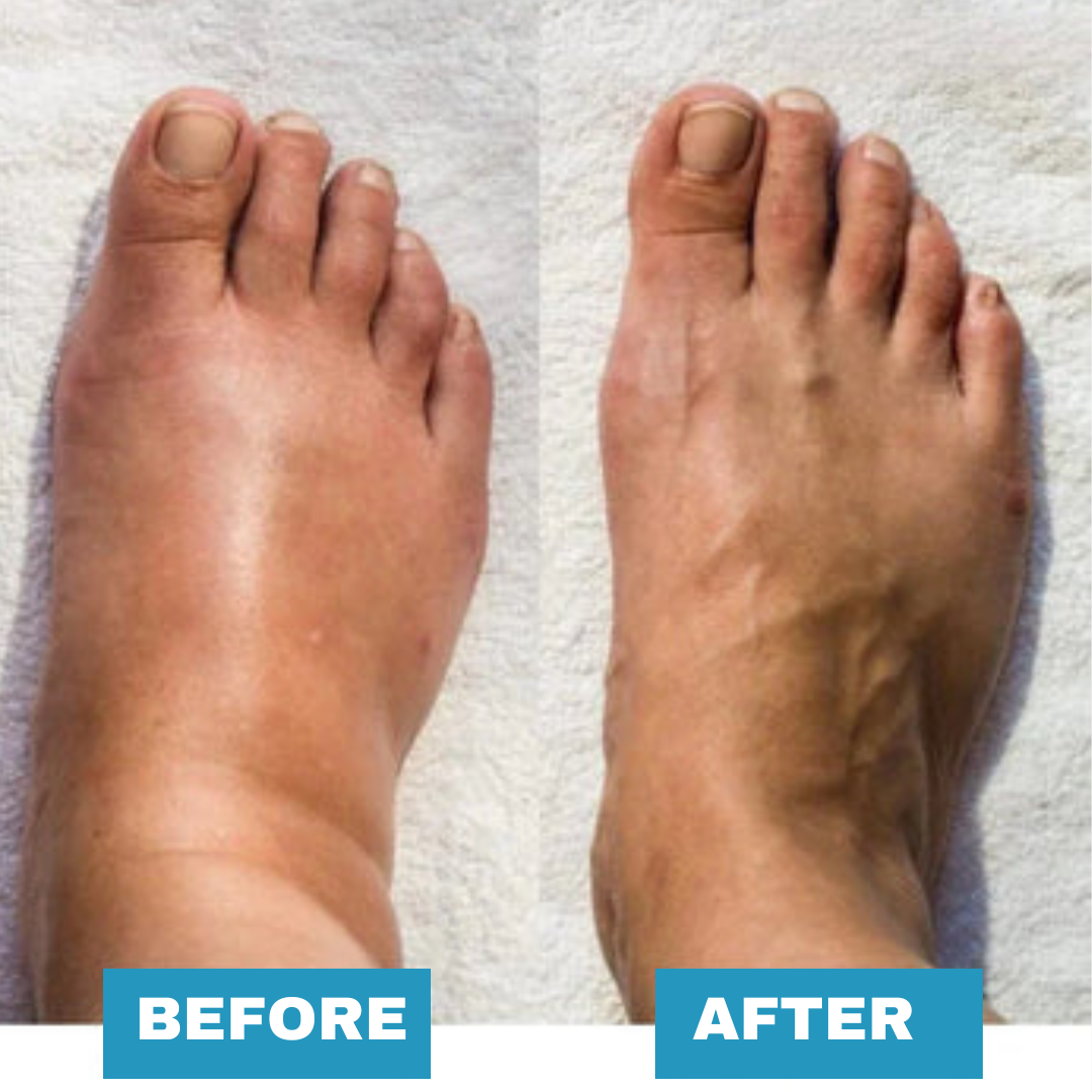 EMS Foot Massager - For Lasting Foot Pain Relief